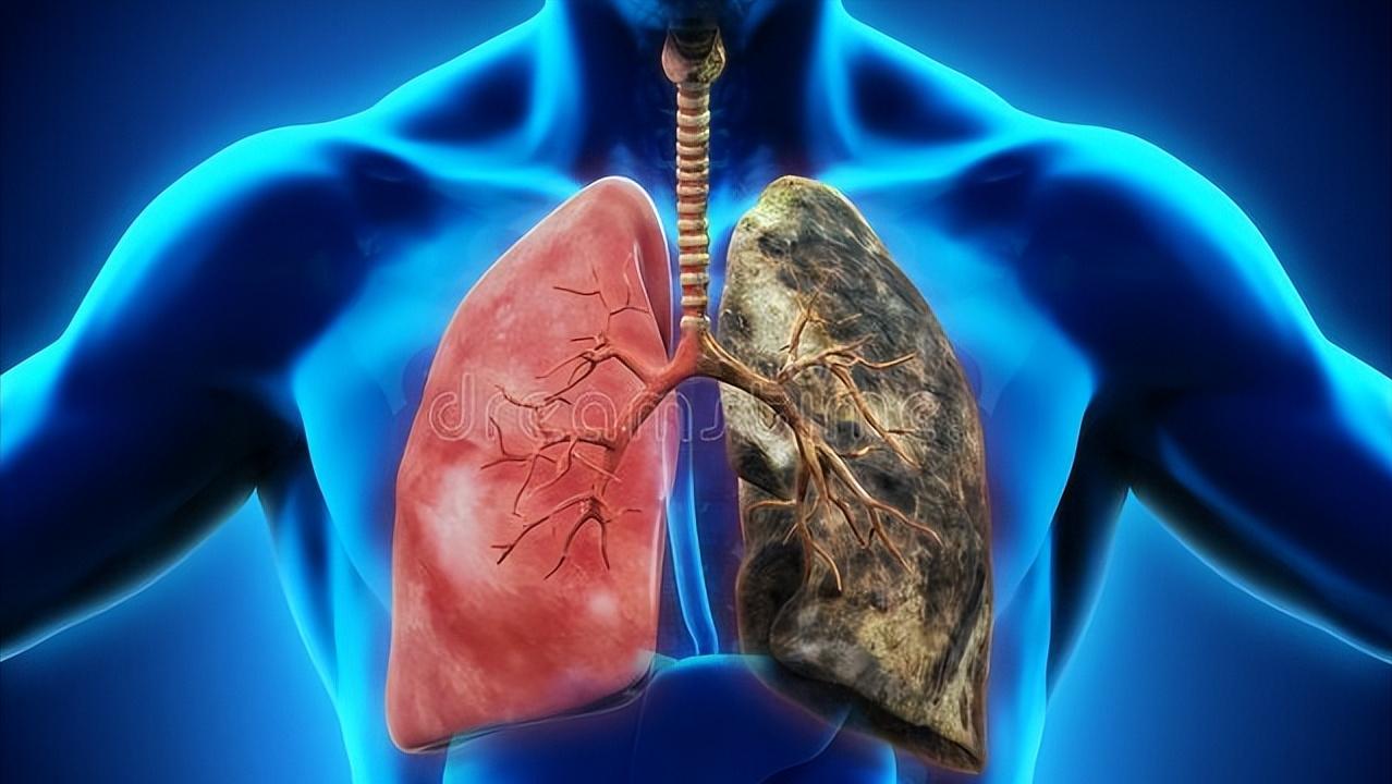 脾虚有痰吃什么中成药化痰健脾,不抽烟痰多是什么原因