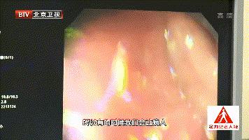 一查竟有两种癌,一查出来就是恶性肿瘤