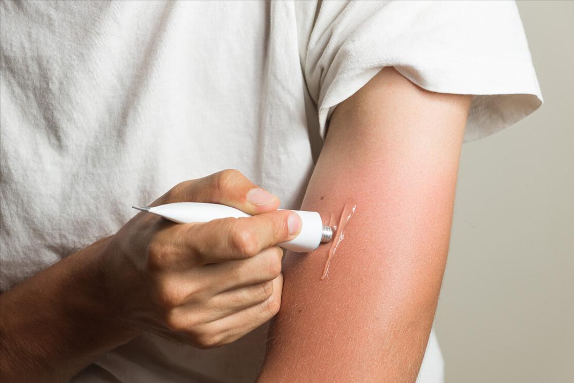 红霉素软膏的淡斑方法真实测评,红霉素软膏淡斑真的有效吗