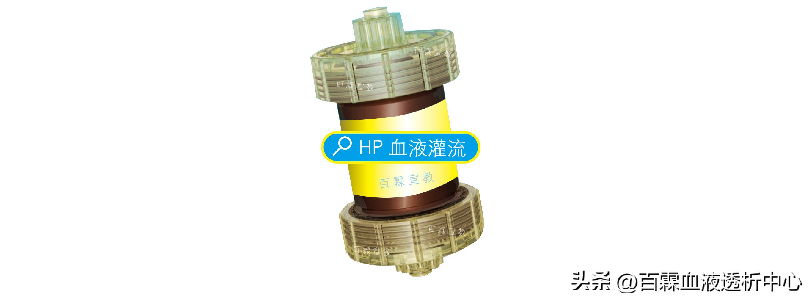 血液透析灌流与血滤哪个效果好,透析血液灌流多久做一次