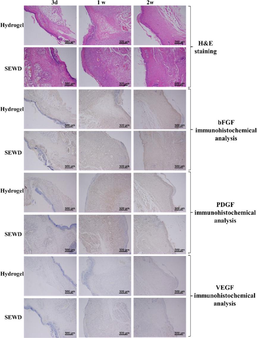 水凝胶敷料适合什么伤口,水凝胶敷料产品详细信息