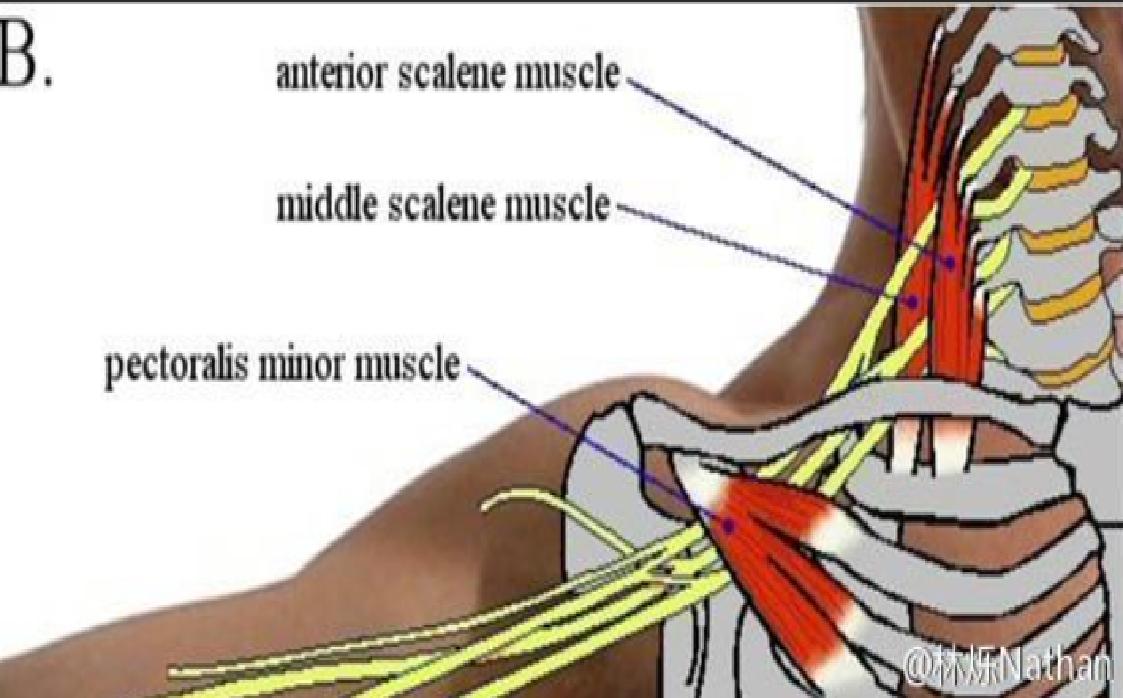 睡觉手指麻木醒来又恢复,手指麻木的最快解决办法
