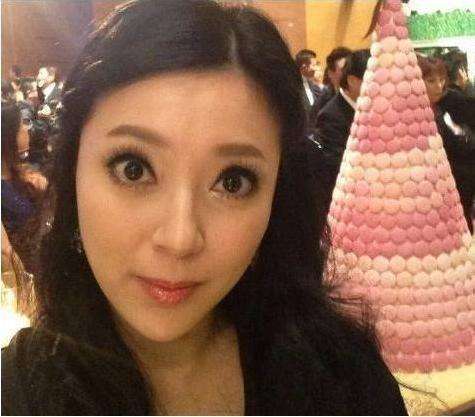 老演员整容脸变形,老年人整容前后照片