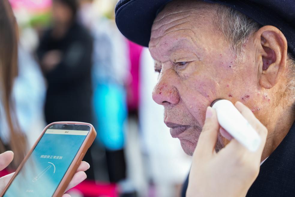 薇诺娜做项目,薇诺娜能干什么