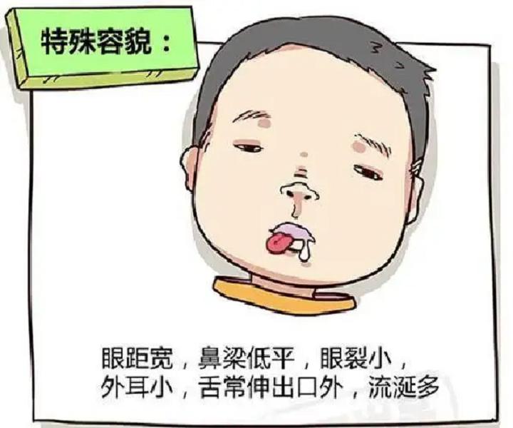 斗和簸箕的科学解释,斗纹和簸箕的科学论证