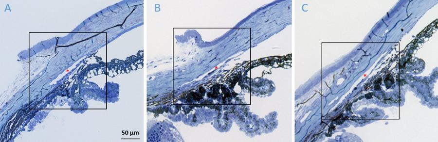 rho激酶抑制剂多少钱,rho激酶抑制剂是什么