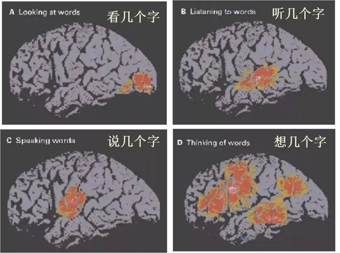 新型原子磁强计：脑磁测量技术的创新与突破丨贝研报02