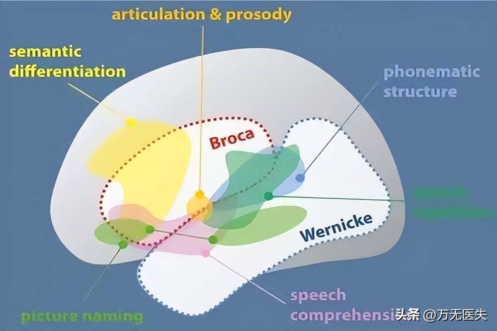 宸﹁剳鍜屽彸鑴戞崯浼ゅ悇鑷甫鏉ョ殑鍗卞,宸﹁剳鎹熶激鍙宠剳浼氭縺鍙戝悧