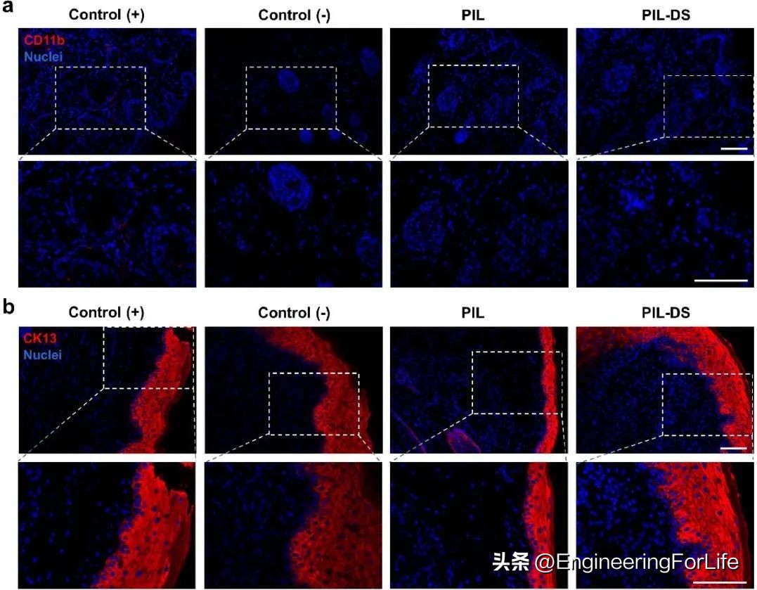 《ActaBiomaterialia》苏州大学：聚离子液体贴片，贴口腔溃疡!