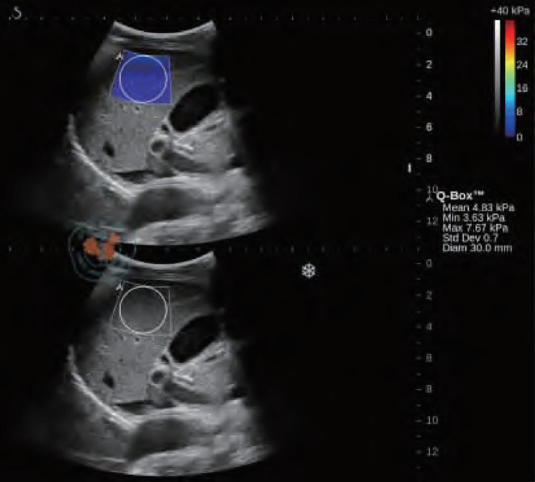 看不见的手发挥作用的机制,看不见手的神奇力量