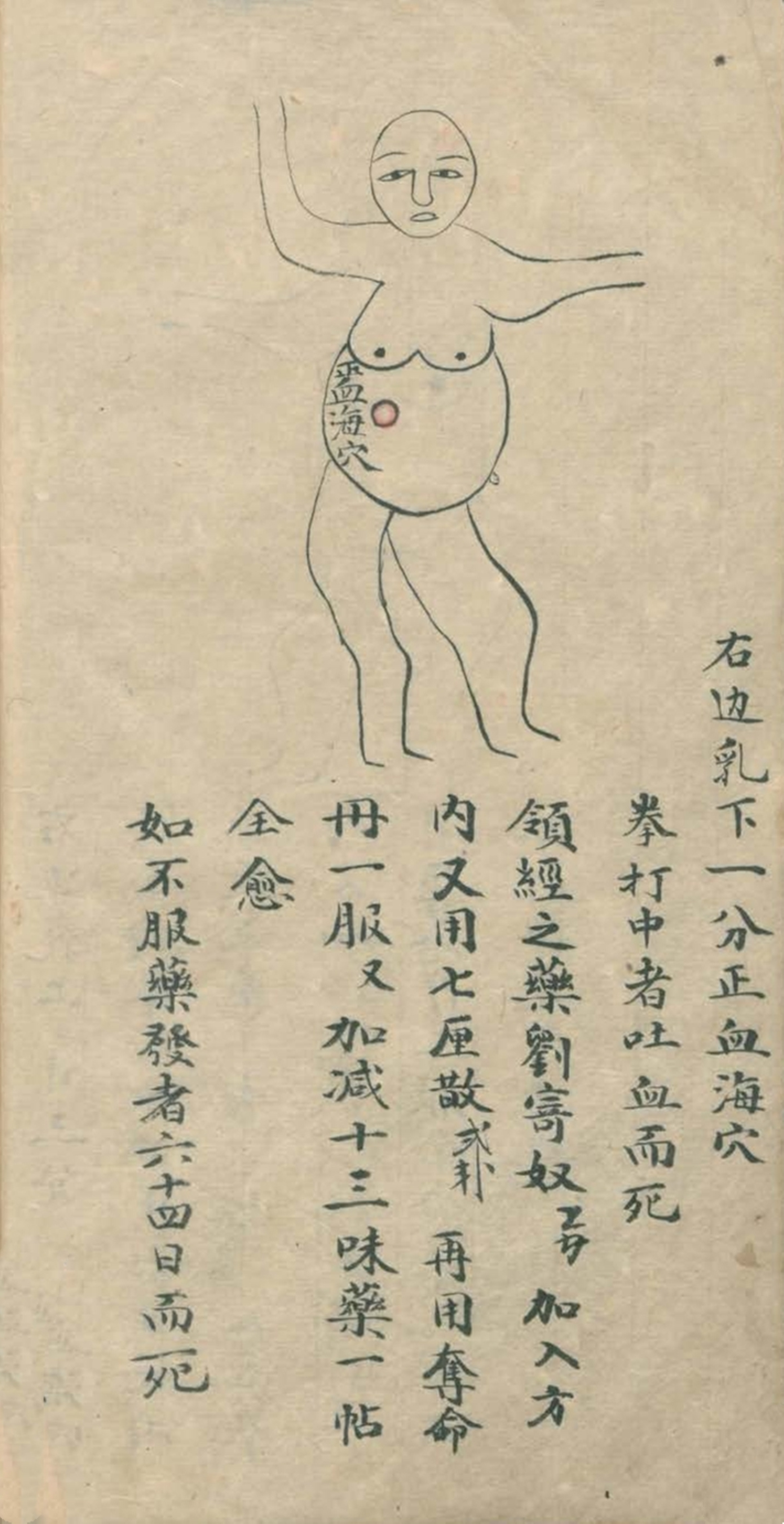 武当秘传跌打八法,民间中医古籍手抄本专医跌打秘方