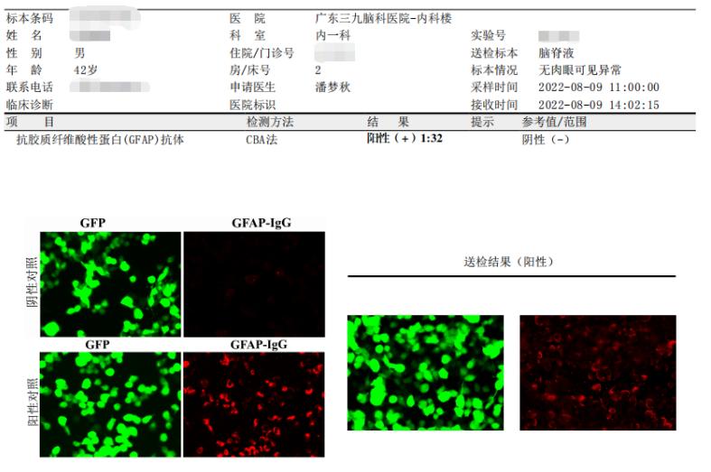 脑炎意识模糊高烧不退全身水肿,男子突然昏迷不醒是什么原因