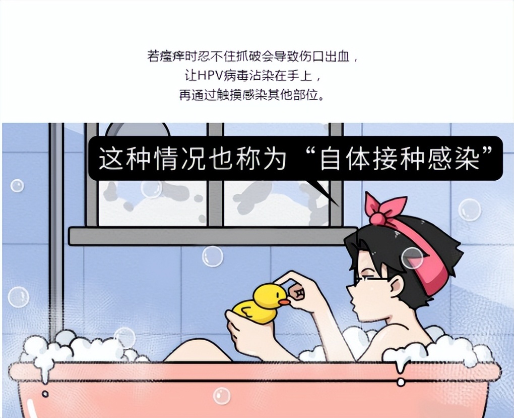 尖锐性湿疣多久不复发算康复了,尖锐性湿疣多久没复发算好了