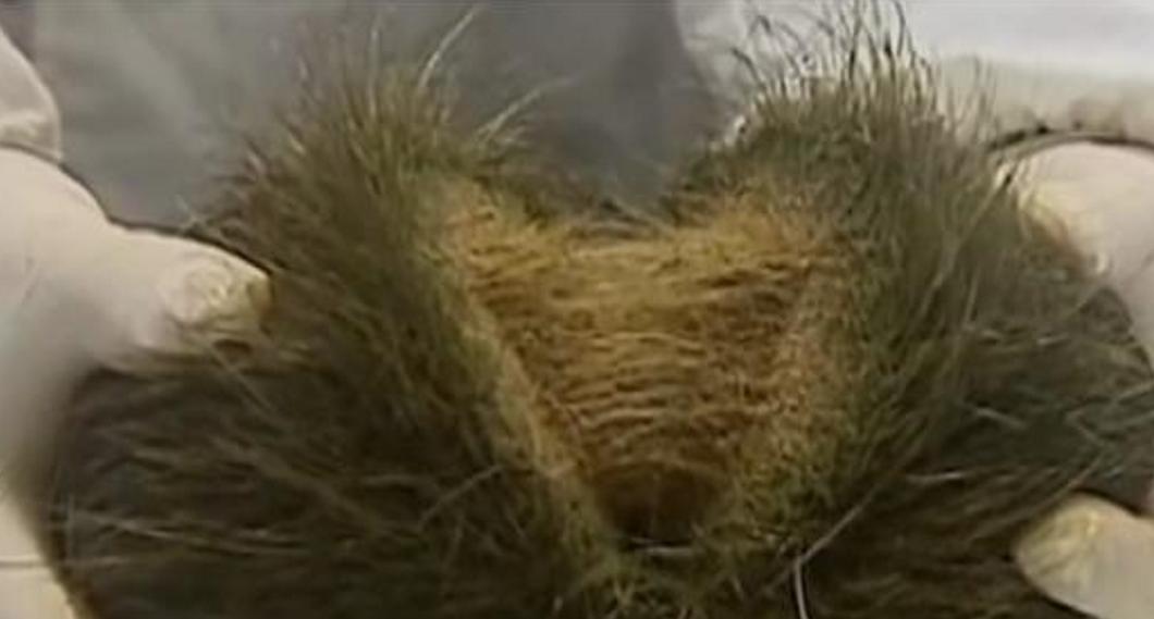 一农民杀猪时意外收获猪宝,农民杀猪得猪宝事件