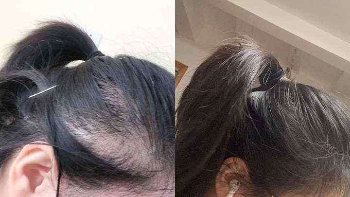 防脱洗发水扔掉可惜有什么妙招,真正做到防脱的洗发水