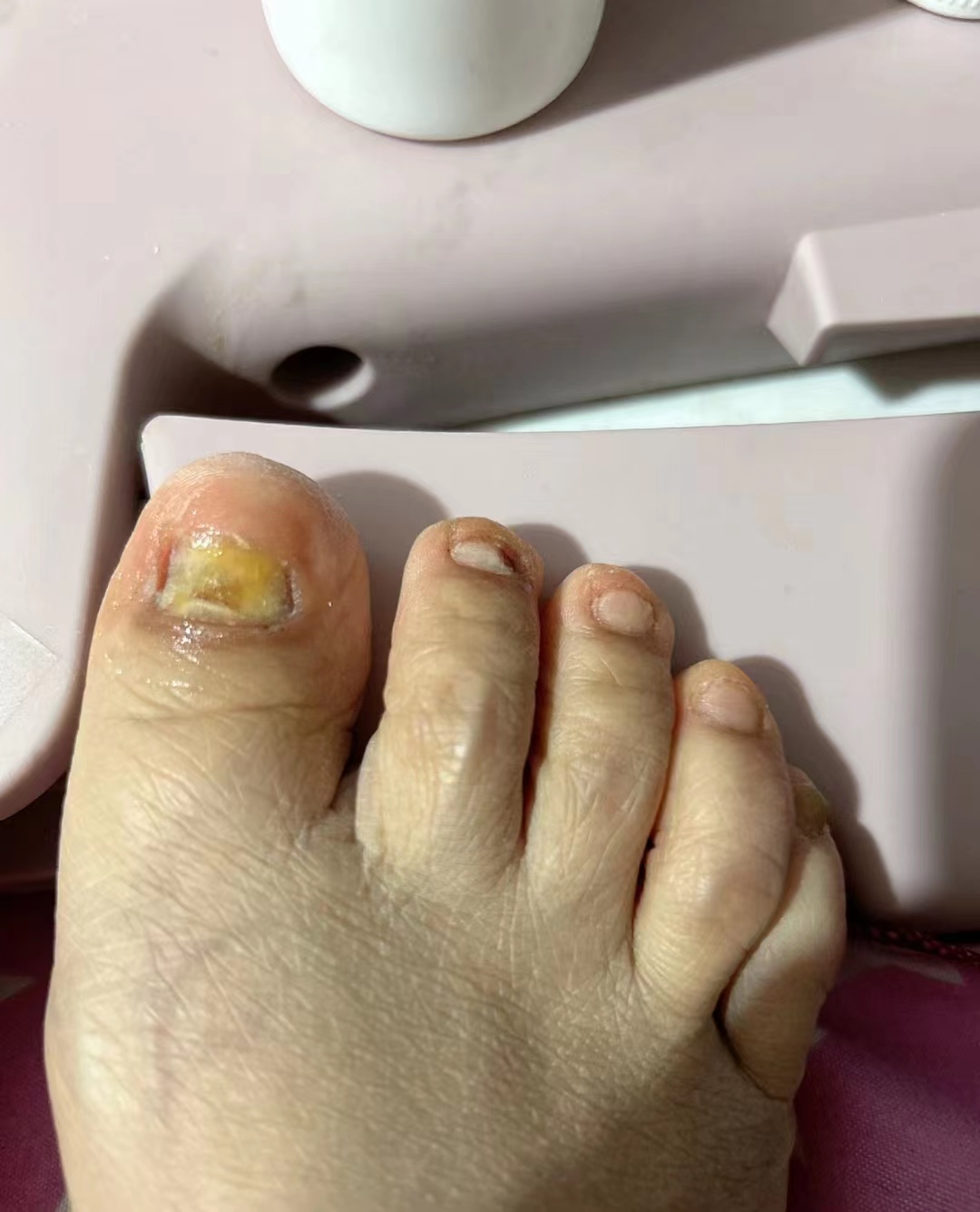 抑菌液推荐排行榜前十名,亲测有效的精华排行榜