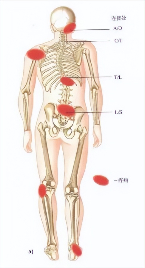 长短腿的原因和解决方法,长短腿引起症状该怎么处理