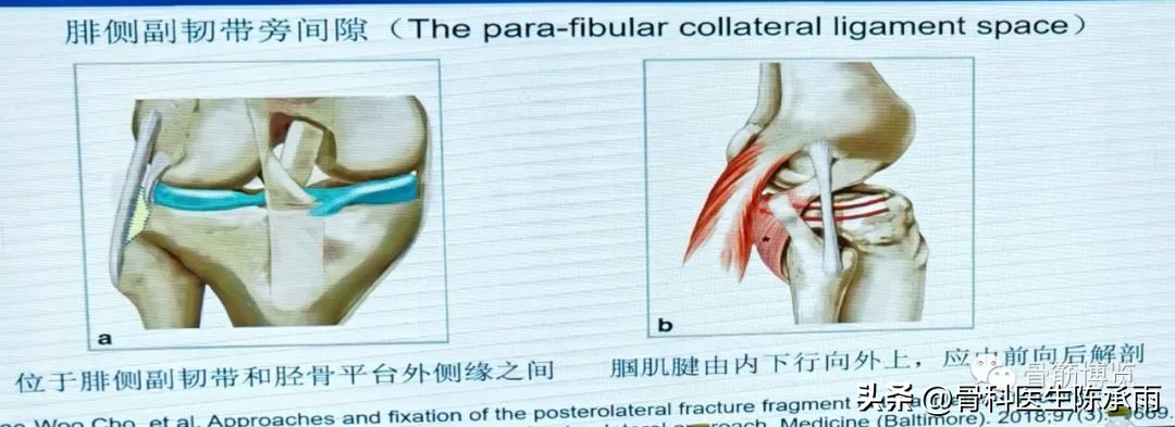 国家卫健委主办的骨创伤专项能力培训项目----下肢损伤学习班