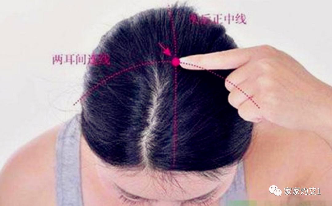 艾灸治疗高血压的方法,高血压阳气瘀阻