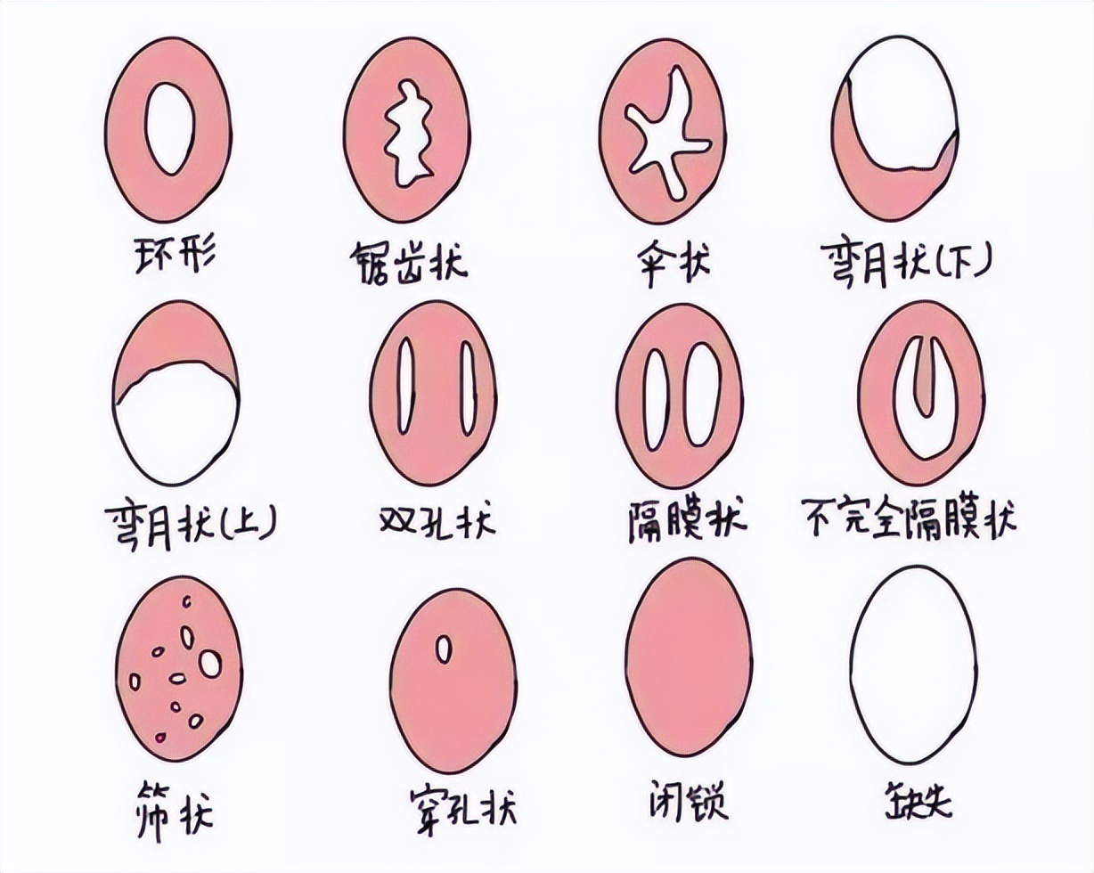 女人第一次一定会“落红”?这层膜到底有何用?别被男人*脑洗**了