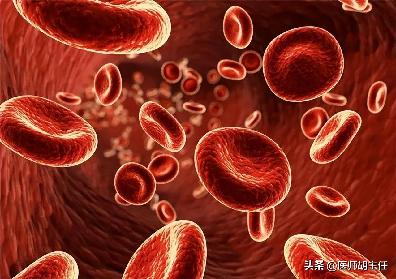 体检发现胆红素高是怎么回事,体检胆红素高怎么快速降下来