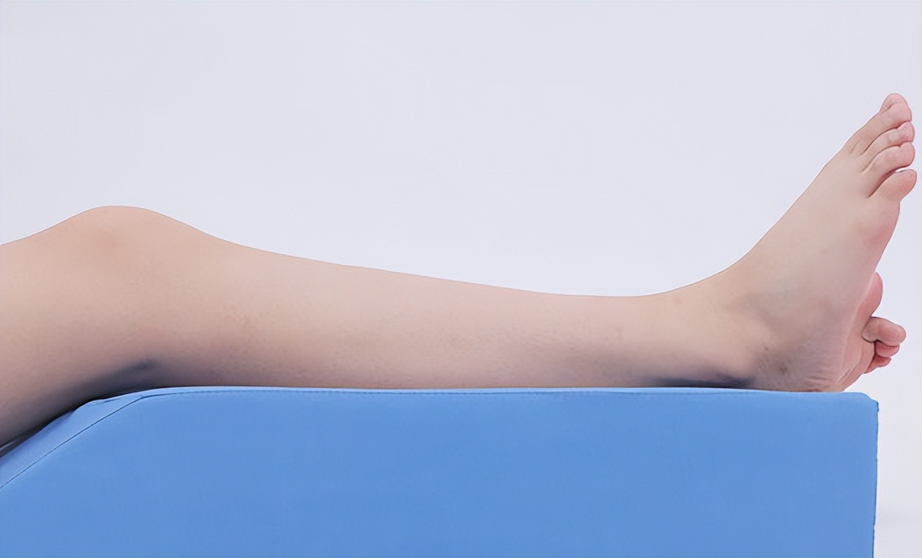 痛风尿酸降下来了还要继续吃药吗,尿酸485有痛风症状不吃药可以吗