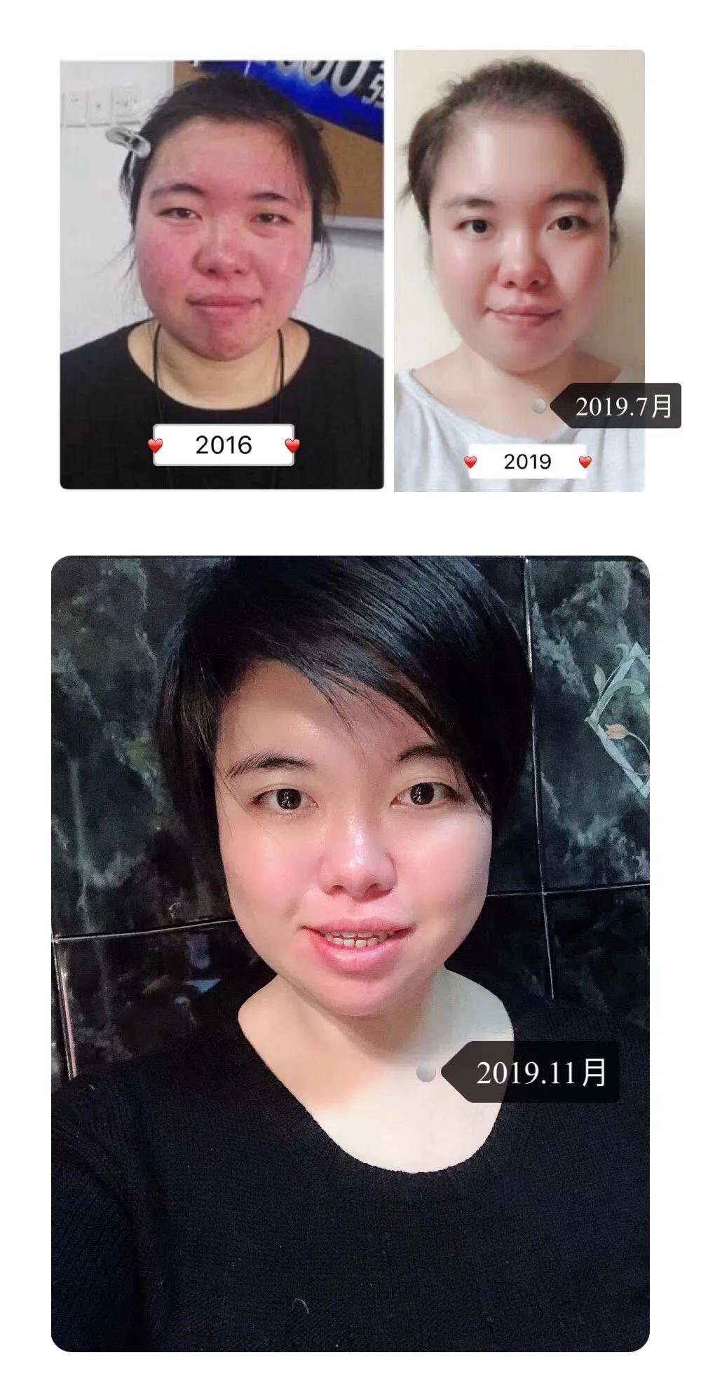 ageloc美颜spa机,agelocspa多少钱