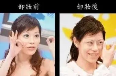 盘点那些整容整的最厉害的人,整容整的最厉害的三位女士