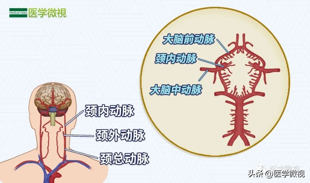 痴呆老人走失完整版,痴呆老人走失多久判定死亡