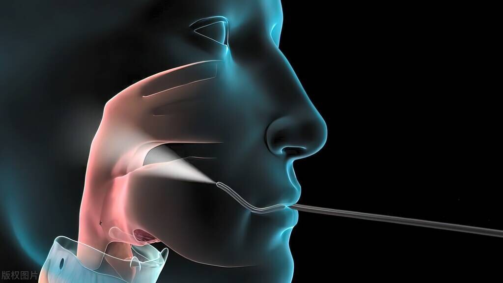 支气管镜检查的注意事项有哪些,支气管镜检查后有什么症状