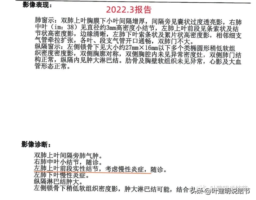 有关肺部结节的知识,医生判定存在风险的肺结节