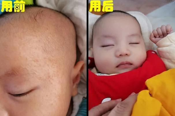 正品宝宝面霜前十名,为啥最近婴儿面霜火了