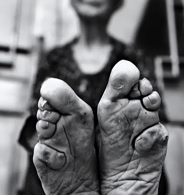 在古人眼里裹小脚美在哪,古代裹小脚和现代裹小脚的区别