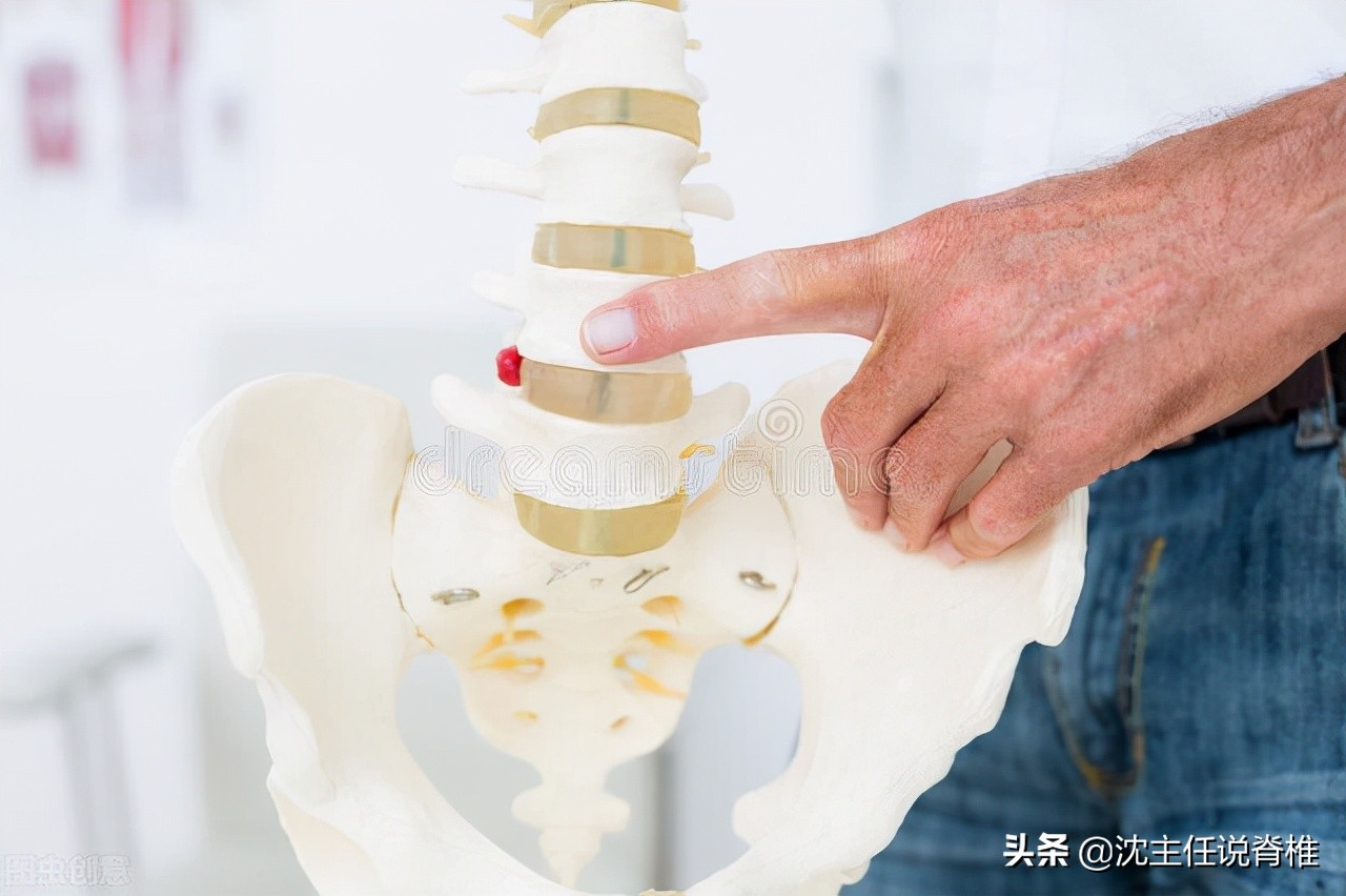 腰痛腰椎间盘突出防治四要点,腰痛腰椎间盘突出康复治疗方案