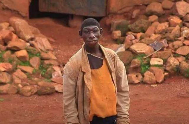 非洲23岁男孩酷似猿猴，不会说话只会叫，是何让他获取粉丝1000万