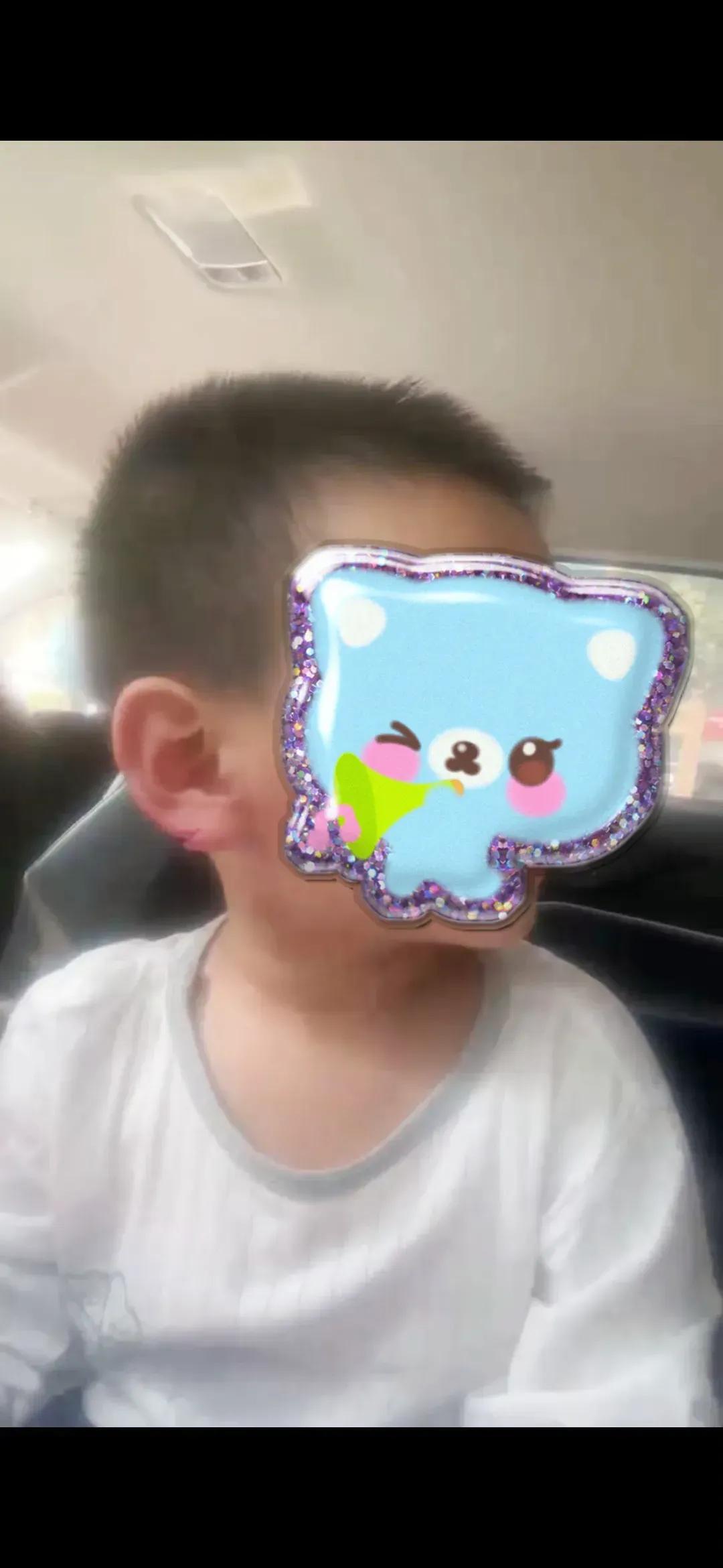 宝宝在幼儿园受伤缝针合理赔偿,幼儿园摔伤缝针赔偿标准