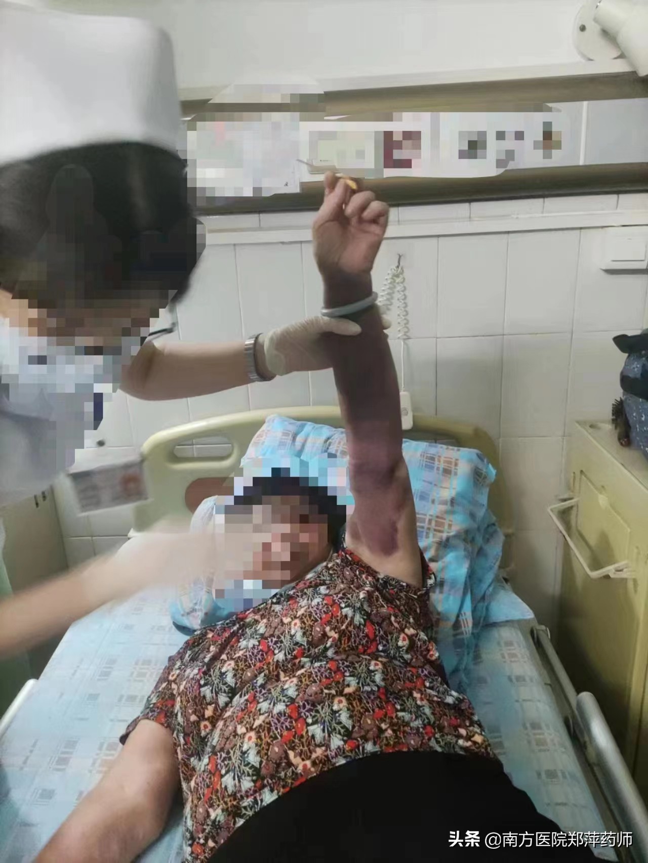 擦活络油后出现青点,擦活络油对血栓有帮助吗