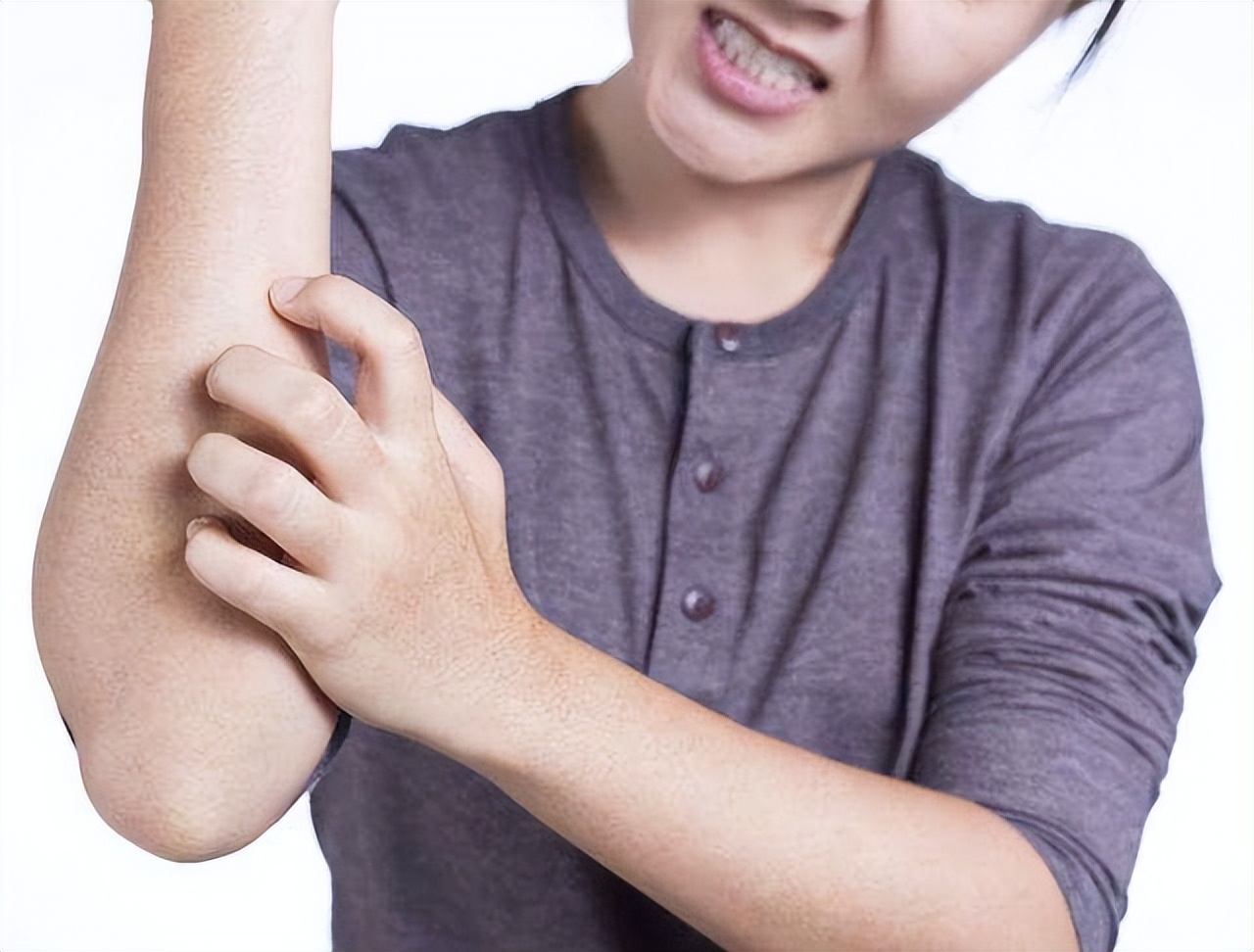 带状疱疹疼是怎么个疼法,带状疱疹引起胸痛要多久才能恢复