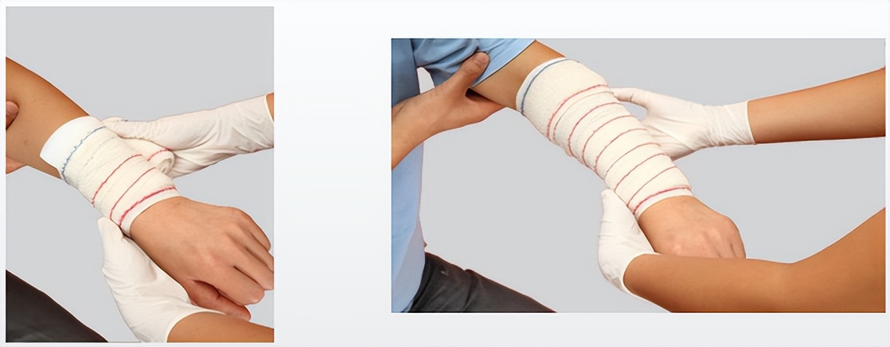 外伤出血的现场包扎技术,外伤出血如何清创包扎