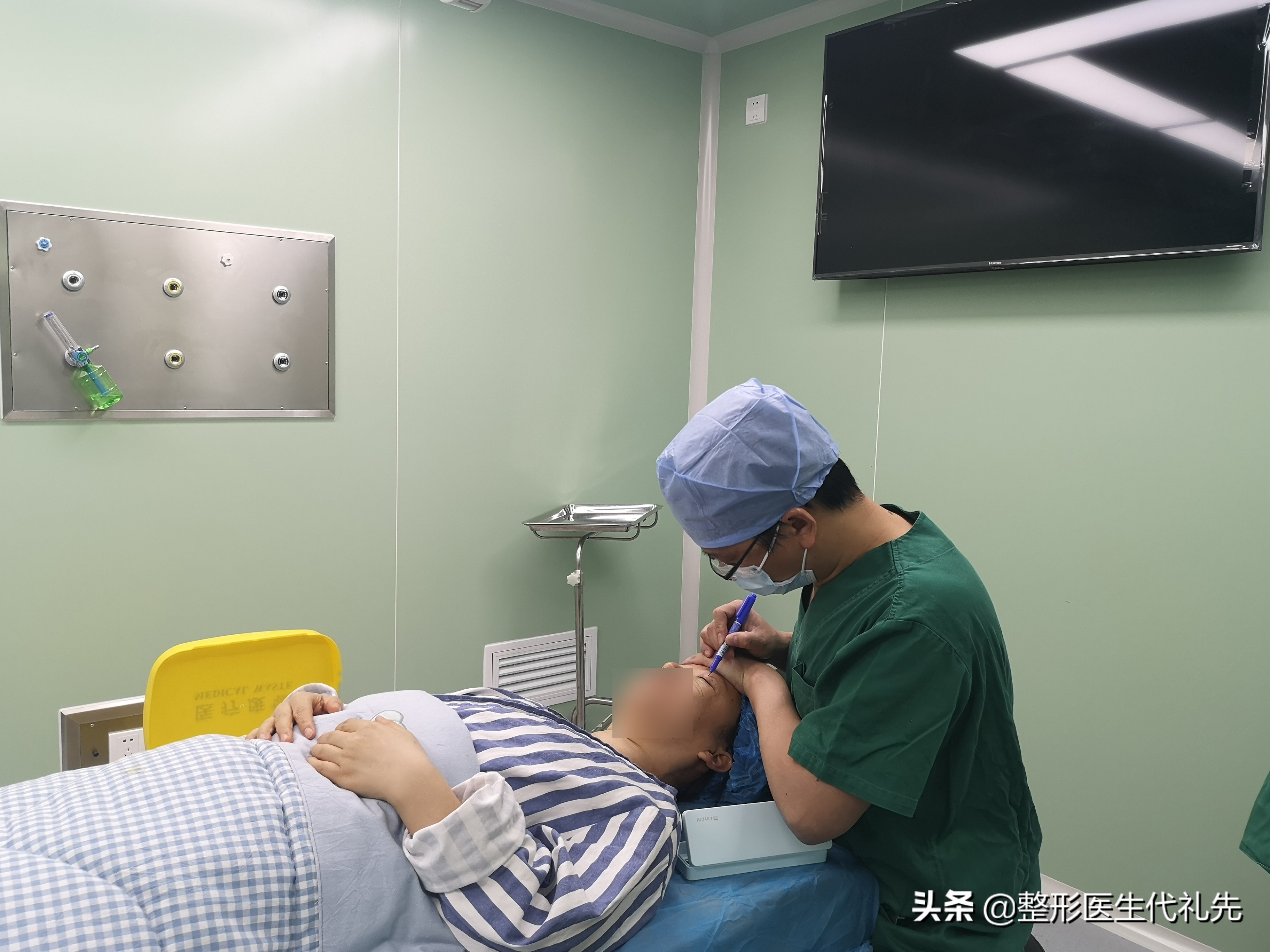 肿泡眼可以抽脂吗,有双眼皮是肿泡眼可以抽脂吗