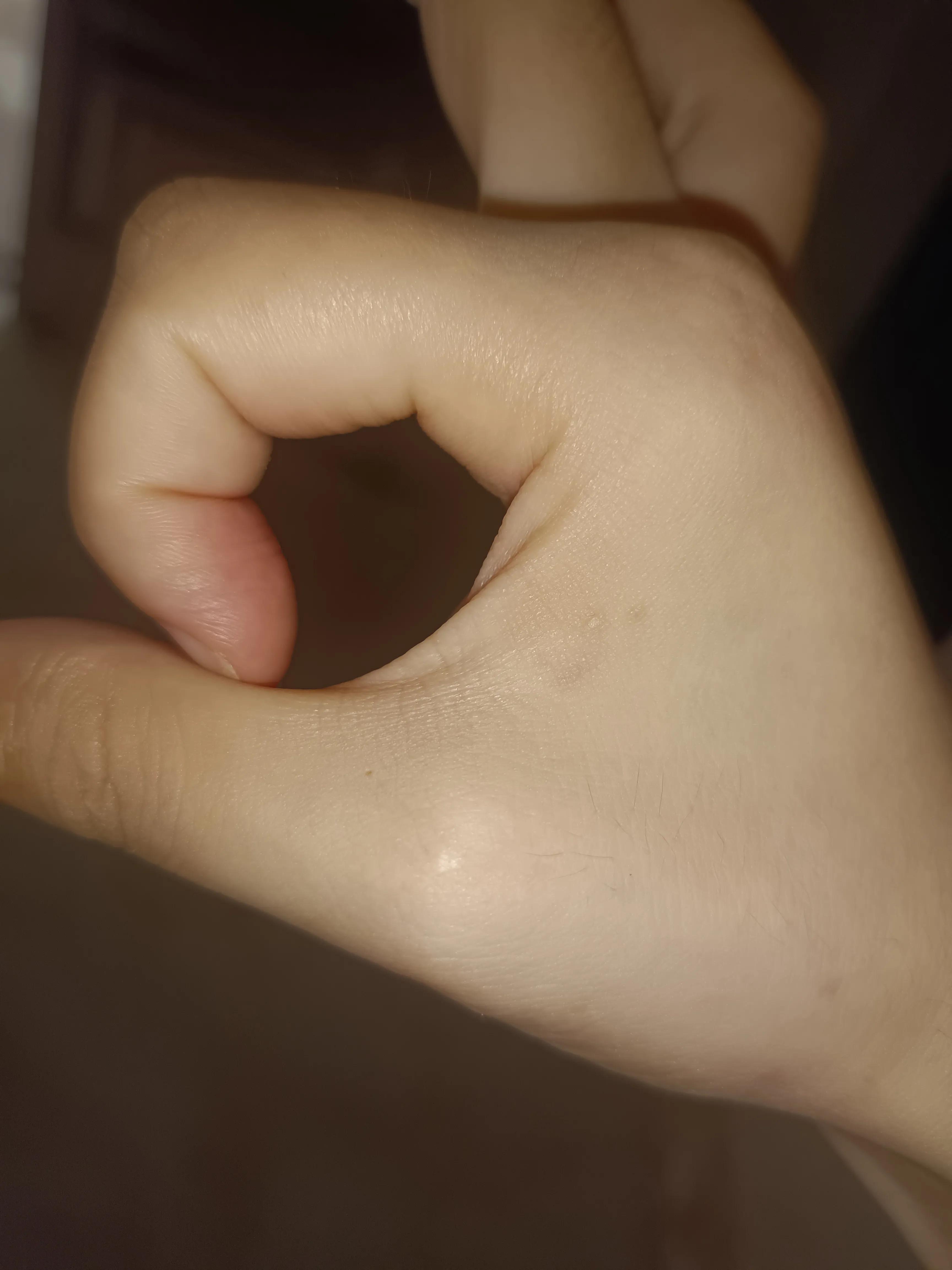 治疗脱发断发的方法,脱发和断发的区别图