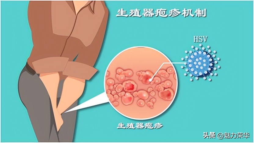 知识课堂丨【性病防治主题宣传周】共抗艾滋，共享健康