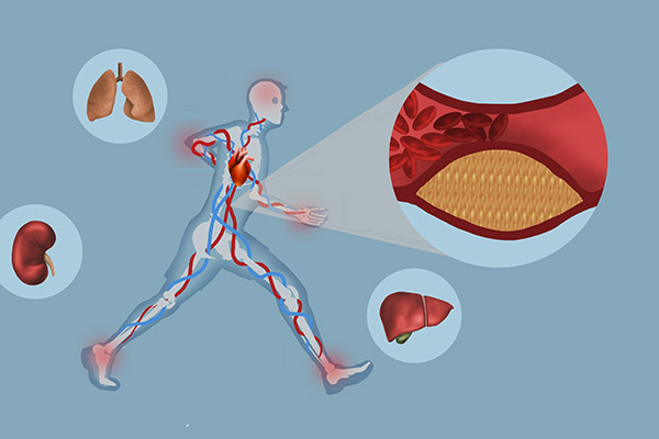 红霉素软膏可以去除老年斑吗,红霉素软膏祛老年斑小妙招