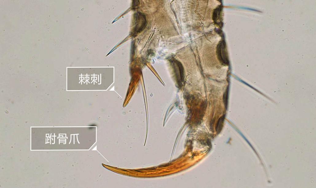 蜱虫比虱子厉害吗,怎么判断蜱虫和虱子