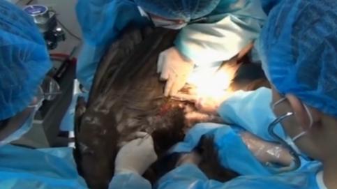 辽宁男子救助秃鹫,沈阳救助秃鹫