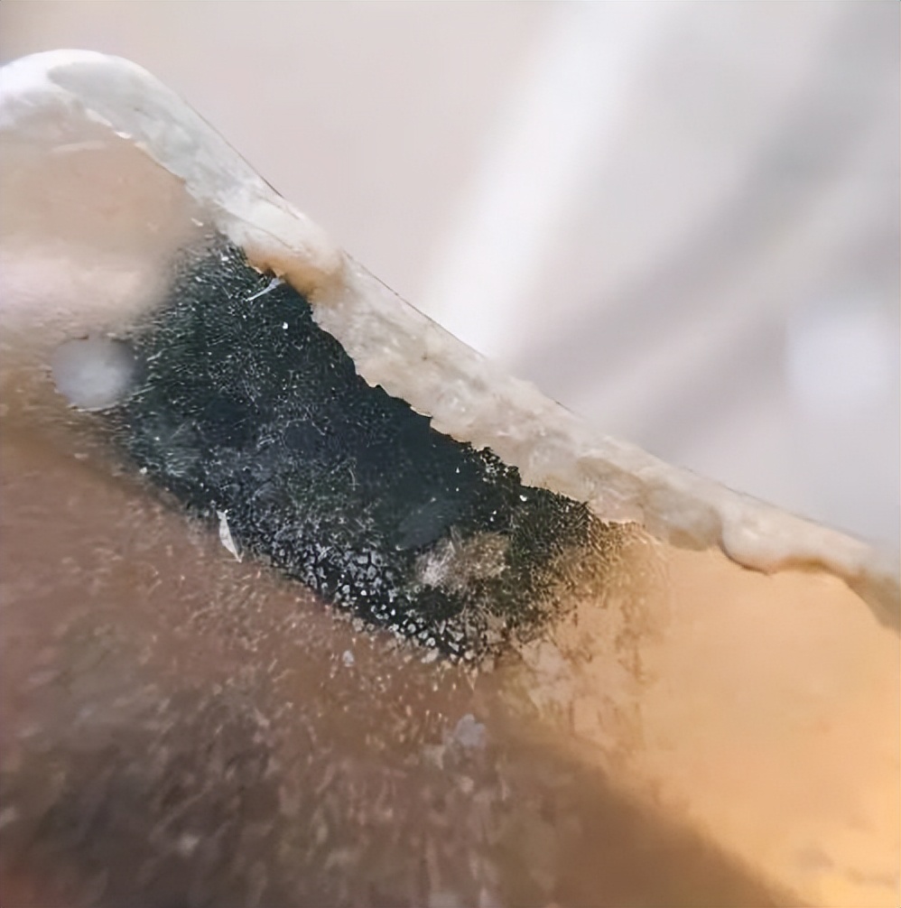 超微小气泡美容有用吗,美容院小气泡