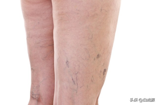 李孔定讲中医治愈糖尿病,水蛭可以治疗痛经吗