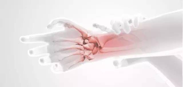 鼠标手腕管综合征挂什么科,白领鼠标手腕管综合征