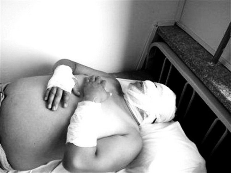 金雕袭击人,金雕袭击人类事件