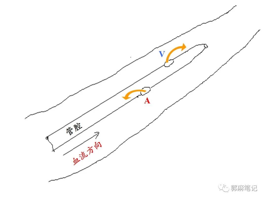 中心静脉穿刺置管术ppt免费,中心静脉置管的护理ppt